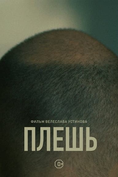 Baldness