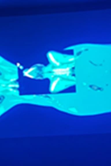 X-Ray Katx