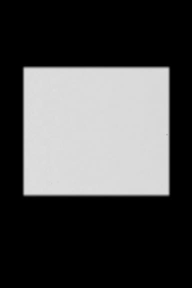 Interval