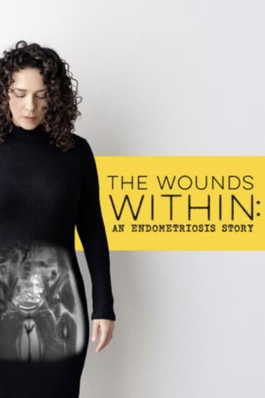 The Wounds Within: An Endometriosis Story