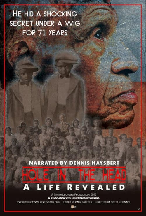 Hole in the Head: A Life Revealed